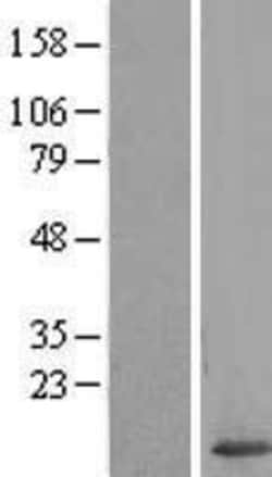Novus Biologicals&trade;&nbsp;Galectin-7 Overexpression Lysate