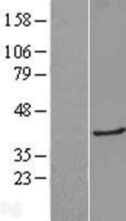 Novus Biologicals&trade;&nbsp;Galectin-8 Overexpression Lysate