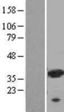 Novus Biologicals&trade;&nbsp;Galectin-9 Overexpression Lysate
