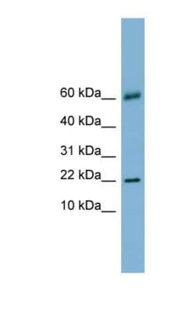 Galectin-14/LGALS14 Antibody, Novus Biologicals:Antibodies:Primary Antibodies