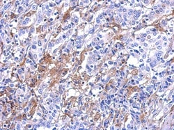 Galectin-3 Antibody, Novus Biologicals 0.1mL; Unlabeled:Antibodies, Polyclonal