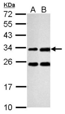 Galectin-3 Antibody, Novus Biologicals 0.1mL; Unlabeled:Antibodies, Polyclonal