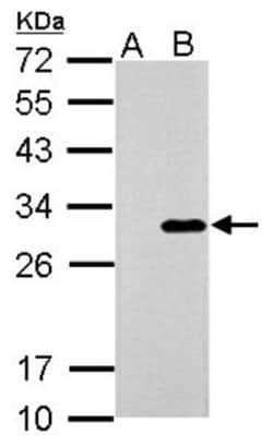 Galectin-3 Antibody, Novus Biologicals 0.1mL; Unlabeled:Antibodies, Polyclonal