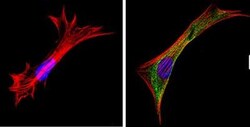 Galectin-3 Antibody (A3A12) - BSA Free, Novus Biologicals 0.1mg; Unlabeled:Antibodies,