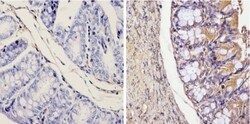 Galectin-3 Antibody (A3A12) - BSA Free, Novus Biologicals 0.1mg; Unlabeled:Antibodies,