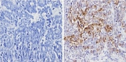 Galectin-3 Antibody (A3A12) - BSA Free, Novus Biologicals 0.1mg; Unlabeled:Antibodies,