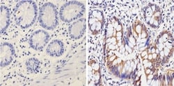 Galectin-3 Antibody (A3A12) - BSA Free, Novus Biologicals 0.1mg; Unlabeled:Antibodies,