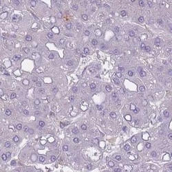 Galectin-9 Antibody, Novus Biologicals 25 &mu;L, Unlabeled:Antibodies,