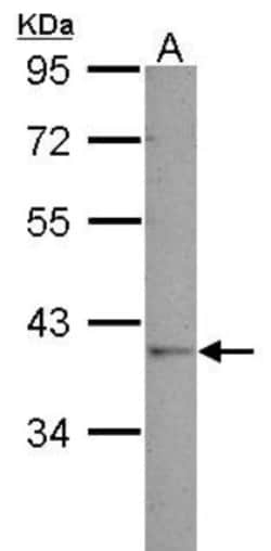 GALM Antibody, Novus Biologicals 0.1mL; Unlabeled:Antibodies, Polyclonal