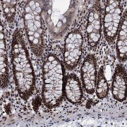 GALNT11 Antibody, Novus Biologicals:Antibodies:Primary Antibodies