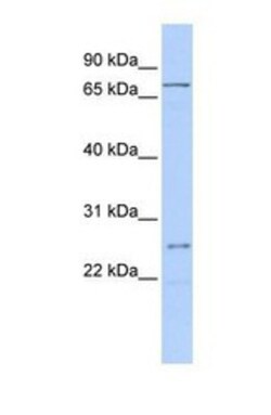 GALNT14 Antibody, Novus Biologicals 0.05mg; Unlabeled:Antibodies, Polyclonal
