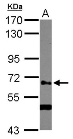 GALNT14 Antibody, Novus Biologicals 0.1mL; Unlabeled:Antibodies, Polyclonal