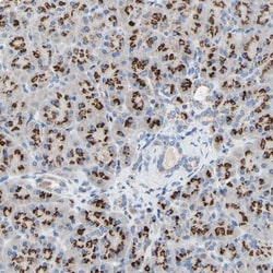 GALNT2 Antibody, Novus Biologicals 25 &mu;L | Buy Online | Novus Biologicals | Fisher Scientific