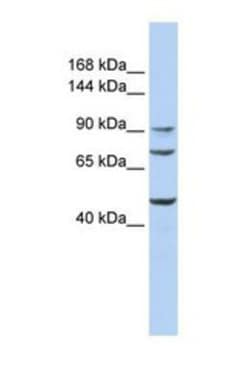 GALNT5 Antibody, Novus Biologicals 0.05mg; Unlabeled:Antibodies, Polyclonal