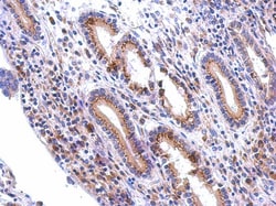 Polypeptide GalNac Transferase 7/GALNT7 Antibody, Novus Biologicals 0.1mL;
