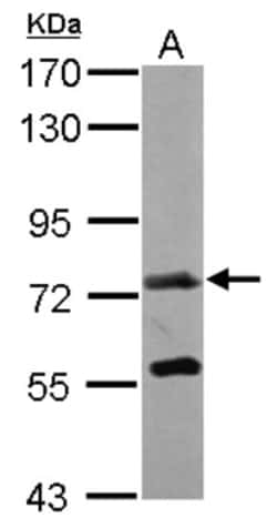 Polypeptide GalNac Transferase 7/GALNT7 Antibody, Novus Biologicals 0.1mL;