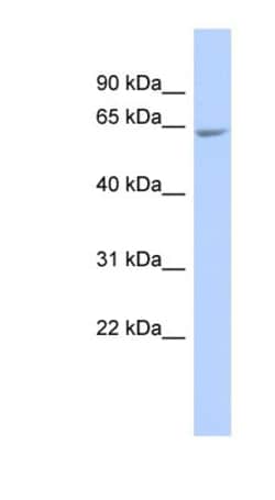 GALNTL4 Antibody, Novus Biologicals 100&mu;L; Unlabeled:Antibodies, Polyclonal