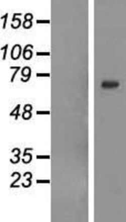 Novus Biologicals&trade;&nbsp;GALNTL6 Overexpression Lysate