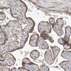 GALNTL6 Antibody, Novus Biologicals:Antibodies:Primary Antibodies