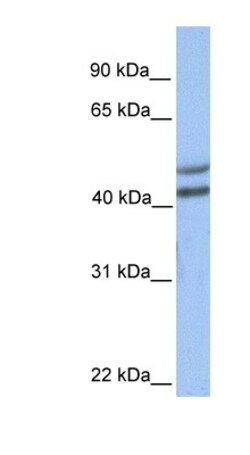 GALT Antibody, Novus Biologicals 100 &mu;L | Buy Online | Novus Biologicals | Fisher Scientific