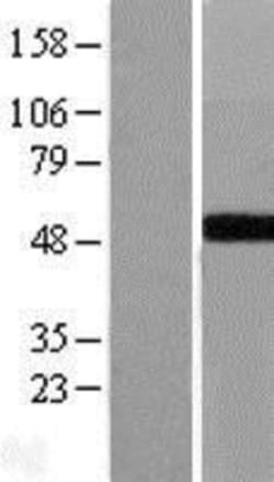 Novus Biologicals™ GALT Overexpression Lysate