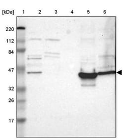 GALT Antibody, Novus Biologicals 25 &mu;L, Unconjugated:Antibodies, Polyclonal