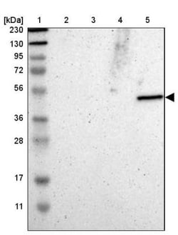 GALT Antibody, Novus Biologicals:Antibodies:Primary Antibodies