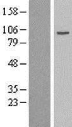 Novus Biologicals&trade;&nbsp;Gamma Adaptin Overexpression Lysate