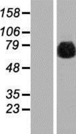 Novus Biologicals&trade;&nbsp;gamma Adducin Overexpression Lysate