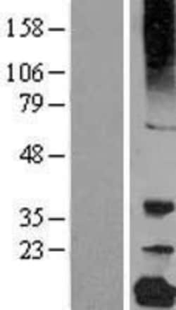 Novus Biologicals&trade;&nbsp;gamma C Crystallin Overexpression Lysate