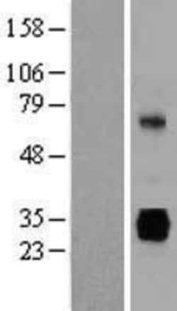 Novus Biologicals™ gamma Sarcoglycan Overexpression Lysate