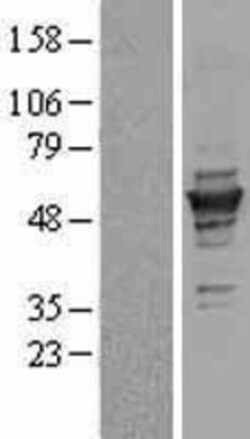 Novus Biologicals™ gamma Tubulin Overexpression Lysate
