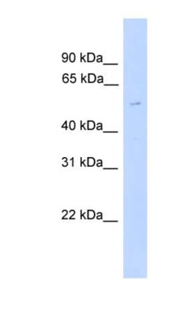 gamma-2 Tubulin Antibody, Novus Biologicals 100&mu;L; Unlabeled:Antibodies,