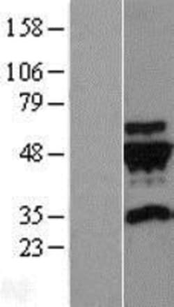 Novus Biologicals&trade;&nbsp;gamma-2 Tubulin Overexpression Lysate
