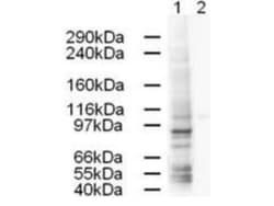 Gamma Adaptin Antibody, Novus Biologicals 0.1mg; Unlabeled:Antibodies,
