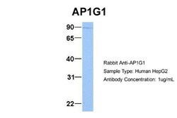 Gamma Adaptin Antibody, Novus Biologicals 100&mu;L; Unlabeled:Antibodies,