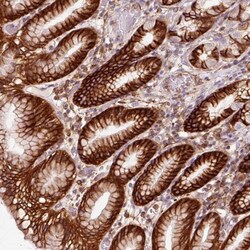 gamma Adducin Antibody, Novus Biologicals 25 &mu;L, Unlabeled:Antibodies,