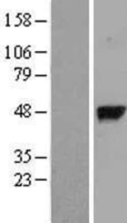 Novus Biologicals&trade;&nbsp;gamma-glutamyl hydrolase Overexpression Lysate