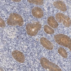 gamma-Glutamylcyclotransferase/CRF21/GGCT Antibody, Novus Biologicals 0.1mL;