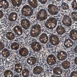 gamma-Glutamylcyclotransferase/CRF21/GGCT Antibody, Novus Biologicals 0.1mL;