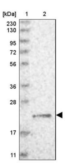 gamma-Glutamylcyclotransferase/CRF21/GGCT Antibody, Novus Biologicals 0.1mL;