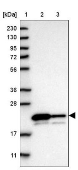 gamma-Glutamylcyclotransferase/CRF21/GGCT Antibody, Novus Biologicals 0.1mL;