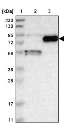 Gamma-Glutamyltransferase 7 Antibody, Novus Biologicals 0.1mL; Unlabeled:Antibodies,