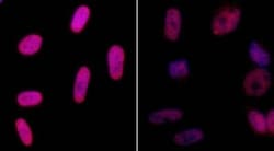 Histone H2AX, p Ser139 Antibody, Novus Biologicals 0.1mL; Unlabeled:Antibodies,