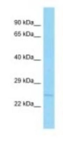 APH1B Antibody, Novus Biologicals 20&mu;L; Unlabeled:Antibodies, Polyclonal