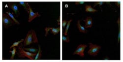gamma Tubulin Antibody (4D11), Novus Biologicals 0.1mg; Unlabeled:Antibodies,