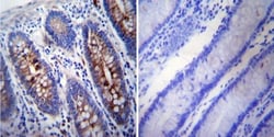 gamma Tubulin Antibody (4D11), Novus Biologicals 0.1mg; Unlabeled:Antibodies,