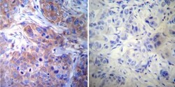 gamma Tubulin Antibody (4D11), Novus Biologicals 0.1mg; Unlabeled:Antibodies,