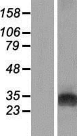 Novus Biologicals&trade;&nbsp;GAMT Overexpression Lysate