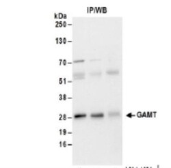 GAMT Antibody, Novus Biologicals 0.1mL; Unlabeled:Antibodies, Polyclonal
